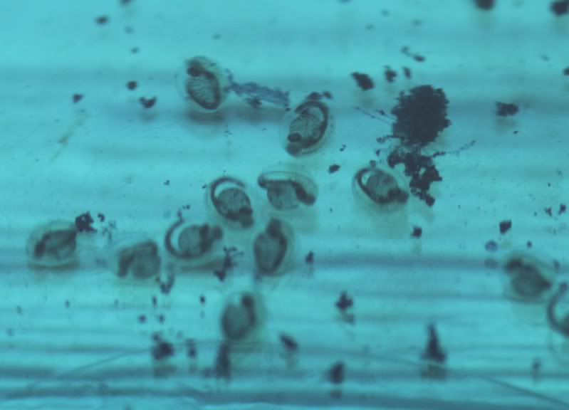 These eggs have been removed from the adults' tank and treated with methylene blue, but the developing embryos are clearly visible.