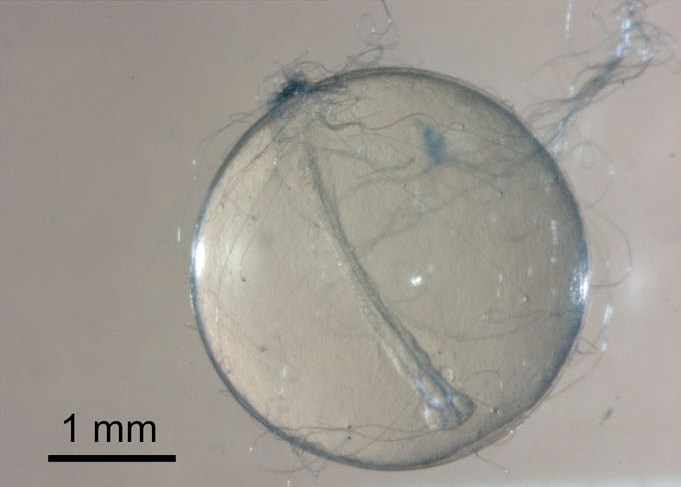 More-or-less freshly-laid egg with adhesive filaments visble on outer surface.